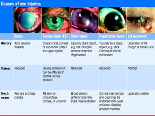 EYE TRAUMA