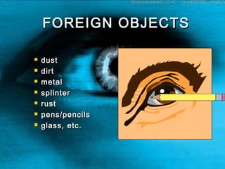 FOREIGN OBJECTSFOREIGN OBJECTS
 dustdust
 dirtdirt
 metalmetal
 splintersplinter
 rustrust
 pens/pencilspens/pencils
 glass, etc.glass, etc.
 