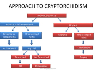 APPROACH TO CRYPTORCHIDISM
PALPABLE GONADS
Hcg test
Retractile or
ectopic testis
No treatment Hcg trial
Assess scrotal development
Undescended
testis
Descended Not Descended
FU Orchidopexy
Undescended
testis
Anorchia
Surgery
Laparoscopy
www.dnbpediatrics.com
 