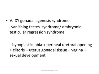 • V. XY gonadal agenesis syndrome
- vanishing testes syndrome/ embryonic
testicular regression syndrome
- hypoplastic labia + perineal urethral opening
+ clitoris – uterus gonadal tissue – vagina –
sexual development
www.dnbpediatrics.com
 