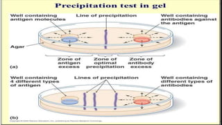 Postzone Antigen antibody reaction | PPT