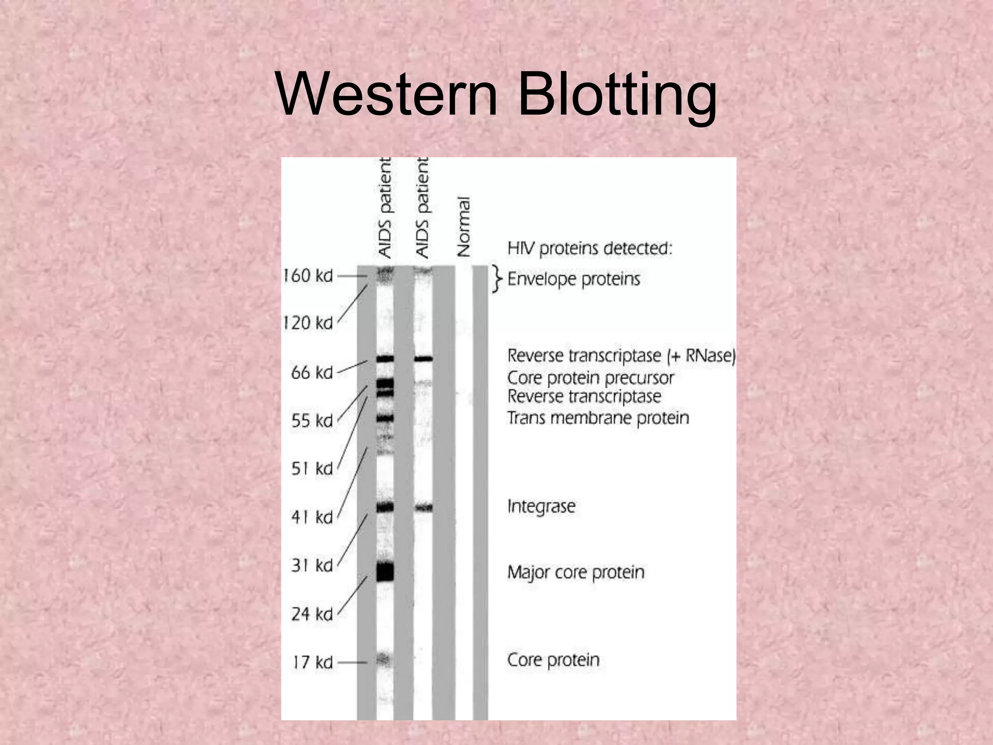 Western Blotting
 