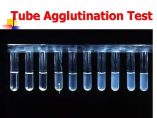 6/7/2022 Department of Microbiology 32
Tube Agglutination Test
 
