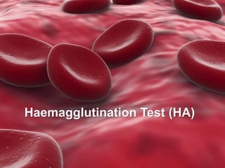 Quantitative Micro
Hemagglutination Test
(HA)
6/7/2022 Department of Microbiology 41
Haemagglutination Test (HA)
 