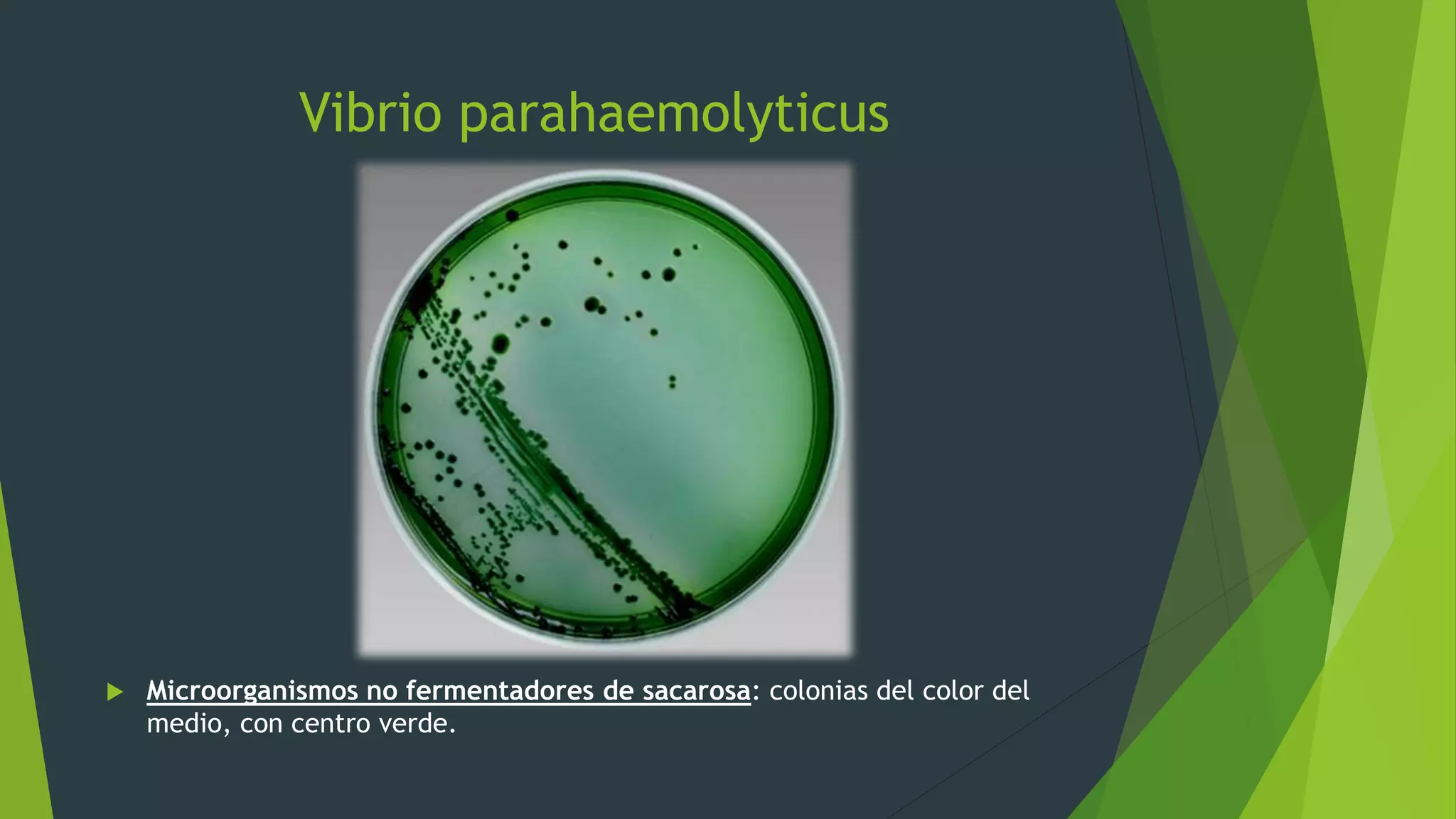 Vibrio parahaemolyticus
 Microorganismos no fermentadores de sacarosa: colonias del color del
medio, con centro verde.
 