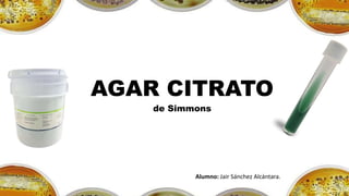 AGAR CITRATO
de Simmons
Alumno: Jair Sánchez Alcántara.
 