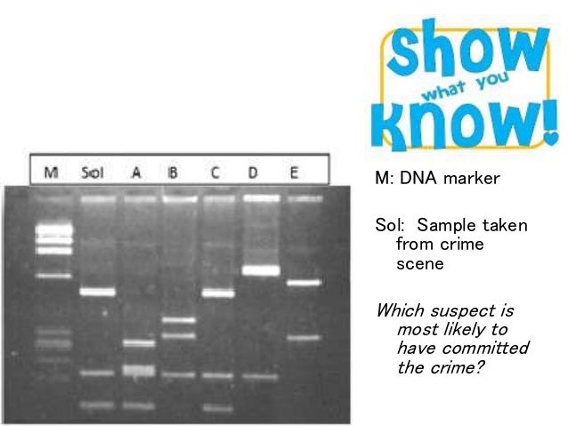 Agarose gel electrophoresis 