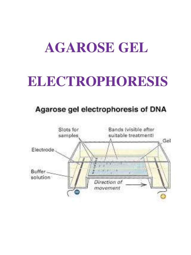 agarose gel electrophoresis