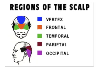 Grading Staging in Androgenetic Alopecia (Male Pattern Baldness) by ...
