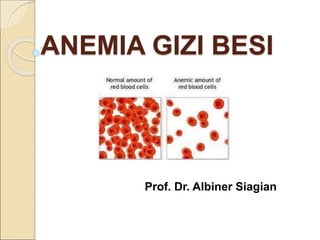 ANEMIA GIZI BESI
Prof. Dr. Albiner Siagian
 