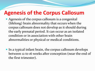 Agenesis of The Corpus Callosum ACC | PPTX