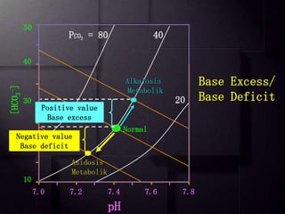52
[HCO
3
-
]
PCO2 = 80 40
20
pH
7.0 7.2 7.4 7.6 7.8
10
20
30
40
50
Asidosis
Metabolik
Negative value
Base deficit
Alkalosis
Metabolik
Positive value
Base excess
Base Excess/
Base Deficit
Normal
 