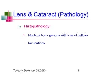 Lens & Cataract (Pathology)
11.

Histopathology:


Nucleus homogenous with loss of celluler
laminations.

Tuesday, December 24, 2013

11

 