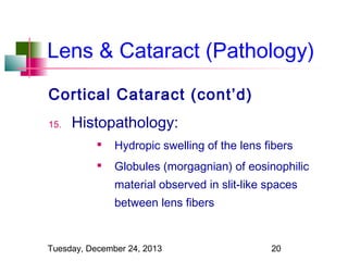 Lens & Cataract (Pathology)
Cortical Cataract (cont’d)
15.

Histopathology:


Hydropic swelling of the lens fibers



Globules (morgagnian) of eosinophilic
material observed in slit-like spaces
between lens fibers

Tuesday, December 24, 2013

20

 