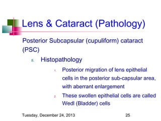 Lens & Cataract (Pathology)
Posterior Subcapsular (cupuliform) cataract
(PSC)
8.

Histopathology
1.

Posterior migration of lens epithelial
cells in the posterior sub-capsular area,
with aberrant enlargement

2.

These swollen epithelial cells are called
Wedl (Bladder) cells

Tuesday, December 24, 2013

25

 