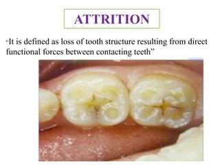 Age changes in oral tissues | PPTX