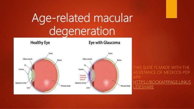 Age-related macular
degeneration
THIS SLIDE IS MADE WITH THE
ASSISTANCE OF MEDICOS PDF
APP
.
HTTPS://BOOKAPP
.PAGE.LINK/S
LIDESHARE
 