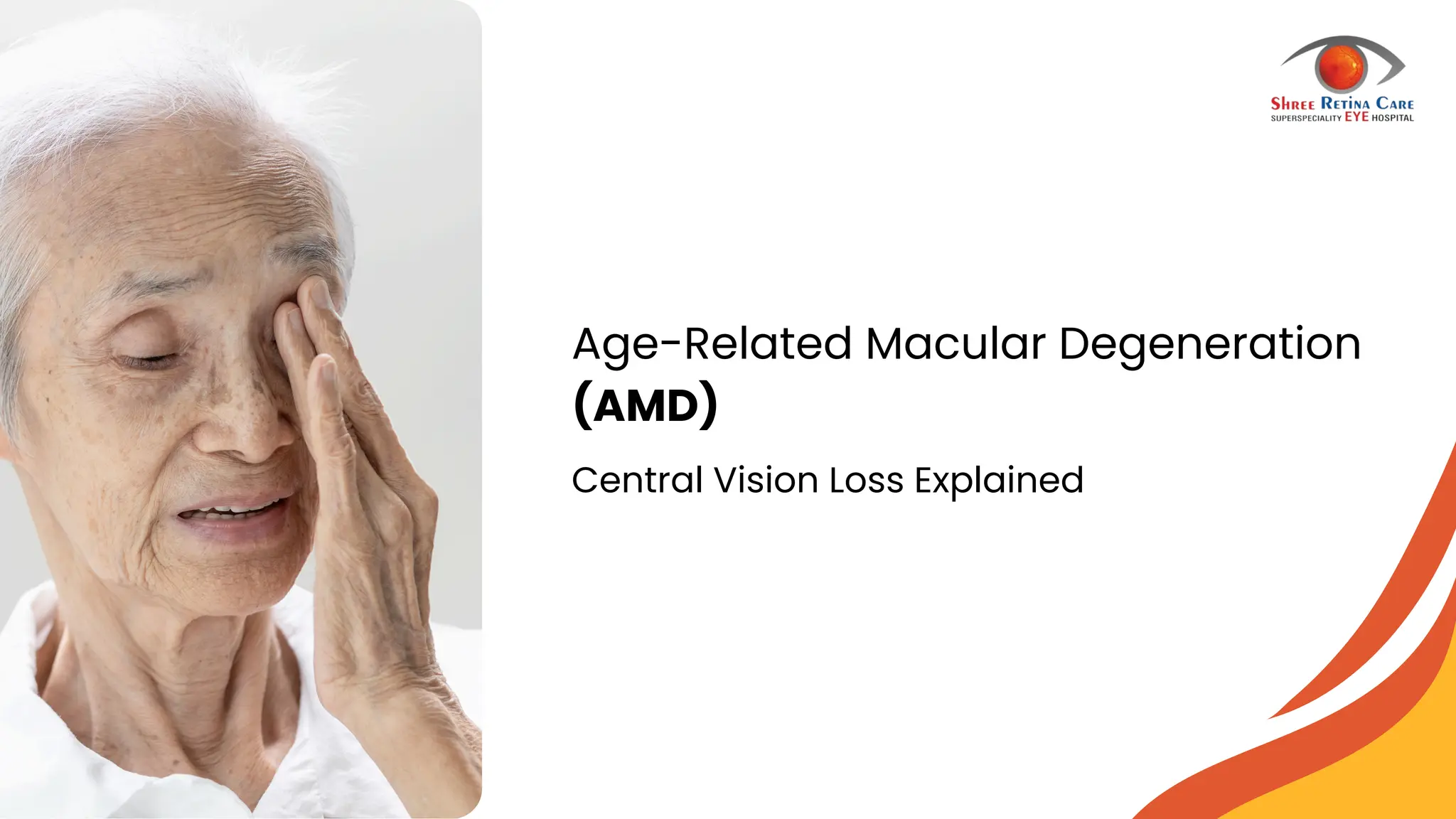 Age-Related Macular Degeneration: (AMD) Central Vision Loss Explained | PDF