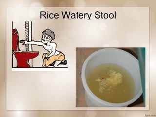 Stool Rice Water Acute Gastroenteritis for Adults and Children | PPT