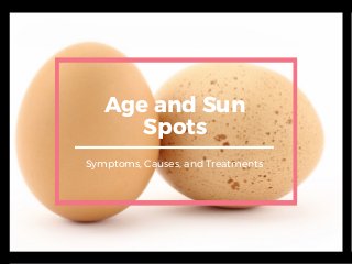 Age and Sun
Spots
Symptoms, Causes, and Treatments
 