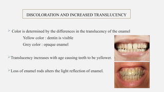 Age changes in enamel and dentin tissues | PPTX