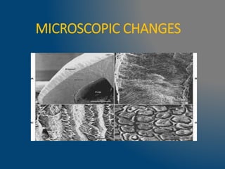 MICROSCOPIC CHANGES
 