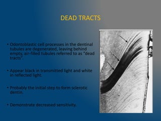 DEAD TRACTS
• Odontoblastic cell processes in the dentinal
tubules are degenerated, leaving behind
empty, air-filled tubules referred to as “dead
tracts”.
• Appear black in transmitted light and white
in reflected light.
• Probably the initial step to form sclerotic
dentin.
• Demonstrate decreased sensitivity.
 