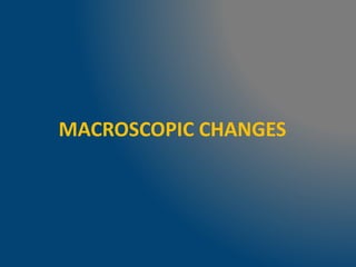 MACROSCOPIC CHANGES
 