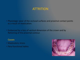 ATTRITION
• Physiologic wear of the occlusal surfaces and proximal contact points
as a result of mastication.
• Evidenced by a loss of vertical dimension of the crown and by
flattening of the proximal contour.
Causes
• Masticatory stress
• Para-functional habits
 