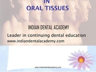 IN
ORAL TISSUES
INDIAN DENTAL ACADEMY
Leader in continuing dental education
www.indiandentalacademy.com

www.indiandentalacademy.com

 