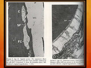 Fibers are interrupted by larger interstitial spaces in
older groups. These ranged from small circular areas of
0.05mm to 0.15mm in diameter to large, oblong areas
of more than 1mm. these interruption resulted in
irregularly spaced areas of dense fiber concentration
separated by regions without suspensory fiber
attachment
The fiber and cellular contents decrease. Fewer
fibroblasts, osteoblasts and cementoblasts can be seen.
78
 