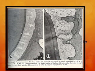 CHANGES IN ALVEOLAR BONE:
 Attrition of tooth substance on occlusal and incisal
surfaces and at the contact points is well recognized
changes of aging.
 Vertical (inter occlusal) dimension and arch continuity
are usually maintained into old age, since wear is
compensated by bone apposition on distal surfaces
and at the fundus of sockets and continuous
apposition of cementum at the apex.
97
 