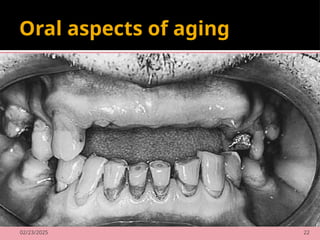 02/23/2025 22
Oral aspects of aging
 