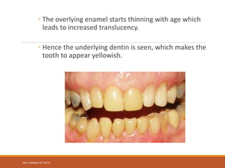 AGE CHANGES IN TEETH powerpoint presentation | PPTX
