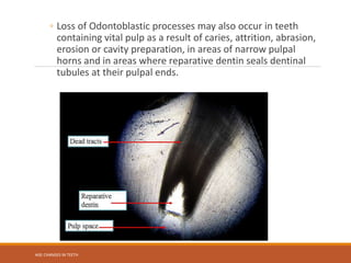 AGE CHANGES IN TEETH powerpoint presentation | PPTX