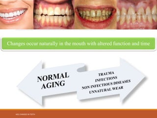 AGE CHANGES IN TEETH powerpoint presentation | PPTX