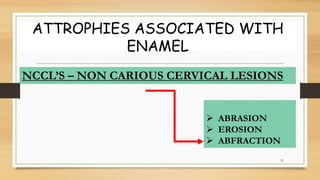 ATTROPHIES ASSOCIATED WITH
ENAMEL
35
NCCL’S – NON CARIOUS CERVICAL LESIONS
 ABRASION
 EROSION
 ABFRACTION
 