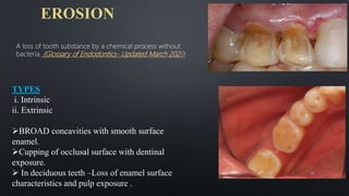 EROSION
38
A loss of tooth substance by a chemical process without
bacteria. (Glossary of Endodontics- Updated March 2020)
TYPES
i. Intrinsic
ii. Extrinsic
BROAD concavities with smooth surface
enamel.
Cupping of occlusal surface with dentinal
exposure.
 In deciduous teeth –Loss of enamel surface
characteristics and pulp exposure .
 