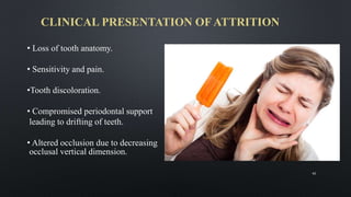 CLINICAL PRESENTATION OF ATTRITION
• Loss of tooth anatomy.
• Sensitivity and pain.
•Tooth discoloration.
• Compromised periodontal support
leading to drifting of teeth.
• Altered occlusion due to decreasing
occlusal vertical dimension.
42
 