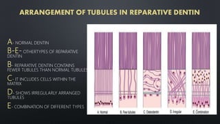 ARRANGEMENT OF TUBULES IN REPARATIVE DENTIN
A- NORMAL DENTIN
B-E- OTHERTYPES OF REPARATIVE
DENTIN
B- REPARATIVE DENTIN CONTAINS
FEWER TUBULES THAN NORMAL TUBULES
C- IT INCLUDES CELLS WITHIN THE
MATRIX
D- SHOWS IRREGULARLY ARRANGED
TUBULES
E- COMBINATION OF DIFFERENT TYPES
52
 