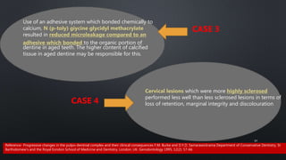 Use of an adhesive system which bonded chemically to
calcium, N (p-toly) giycine glycidyl methacrylate
resulted in reduced microleakage compared to an
adhesive which bonded to the organic portion of
dentine in aged teeth. The higher content of calcified
tissue in aged dentine may be responsible for this.
Cervical lesions which were more highly sclerosed
performed less well than less sclerosed lesions in terms of
loss of retention, marginal integrity and discolouration
CASE 4
CASE 3
57
Reference- Progressive changes in the pulpo-dentinal complex and their clinical consequences F.M. Burke and D.Y.D. Samarawickrama Department of Conservative Dentistry, St
Bartholomew's and the Royal Eondon School of Medicine and Dentistry, London, UK. Gerodontology 1995; 12(2): 57-66
 