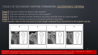 GUSTAFSON'S CRITERIA
60
Stage 0: Pulp horn reaches to above crown equator*
Stage 1: Pulp horn reaches at maximum to crown equator*
Stage 2: Pulp horn exceeds enamel-cementum boundary and falls short to crown equator*
Stage 3: Pulp horn reaches at maximum to enamel-cementum boundary
*crown equator refers to the mid-point of crown length measured from cervical line to the highest cusp tip.
REFERENCE-Age estimation from structural changes of teeth and buccal alveolar bone level K.K. Koh a , J.S. Tan a , P
. Nambiar b, * , Norliza
Ibrahim b , Sunil Mutalik c , Muhammad Khan Asif. 2017 Elsevier Ltd and Faculty of Forensic and Legal Medicine
 