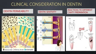 CLINICAL CONSIDERATION IN DENTIN
DENTIN PERMEABILITY DENTIN SENITIVITY
REACTIONS TO DIFFERENT
CAVITY PREPARATION
63
 