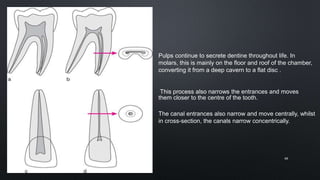 The canal entrances also narrow and move centrally, whilst
in cross-section, the canals narrow concentrically.
Pulps continue to secrete dentine throughout life. In
molars, this is mainly on the floor and roof of the chamber,
converting it from a deep cavern to a flat disc .
This process also narrows the entrances and moves
them closer to the centre of the tooth.
68
 