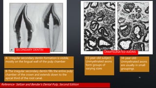 A- irregular secondary dentin formation is visible,
mostly on the lingual wall of the pulp chamber
B-The irregular secondary dentin fills the entire pulp
chamber of the crown and extends down to the
apical third of the root canal.
15-year-old subject.
Unmyelinated axons
form groups of
varying sizes
34-year-old-
Unmyelinated axons
are usually in small
groupings
Reference- Seltzer and Bender's Dental Pulp, Second Edition
76
SECONDARY DENTIN
UNMYELINATED AXONS
 