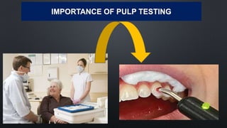 IMPORTANCE OF PULP TESTING
81
 