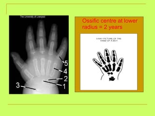 Ossific centre at lower radius = 2 years 