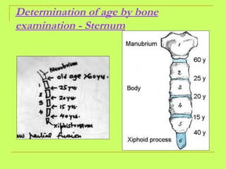 Determination of age by bone examination - Sternum 