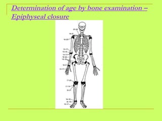 Determination of age by bone examination – Epiphyseal closure 