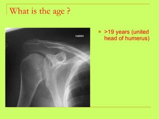 What is the age ? >19 years (united head of humerus) 